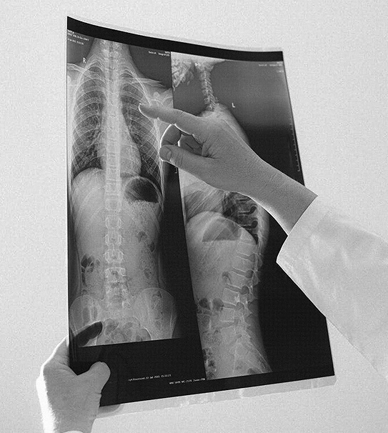 X-Ray examination